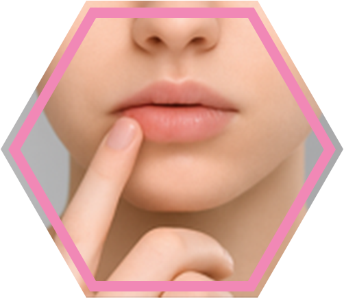 Afinovir_Herpes-Stadien_5